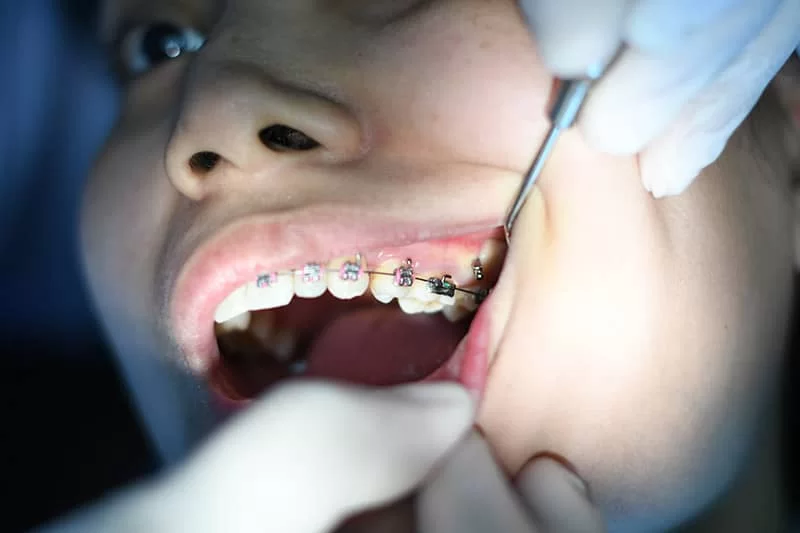 Dentist With Patent With Braces